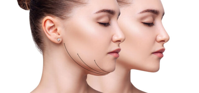 Non-Surgical Facial Slimming and Contouring