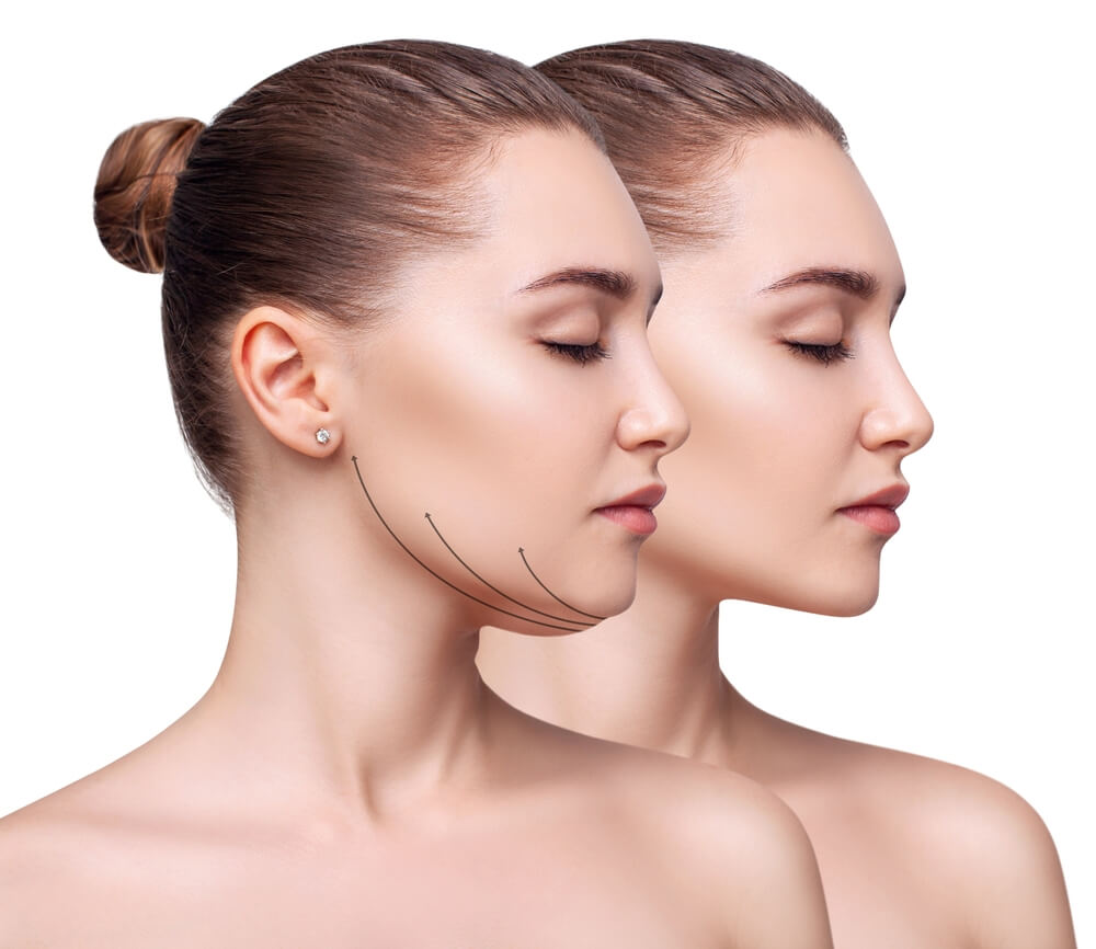 What Are My Options for Non-Surgical Facial Slimming and